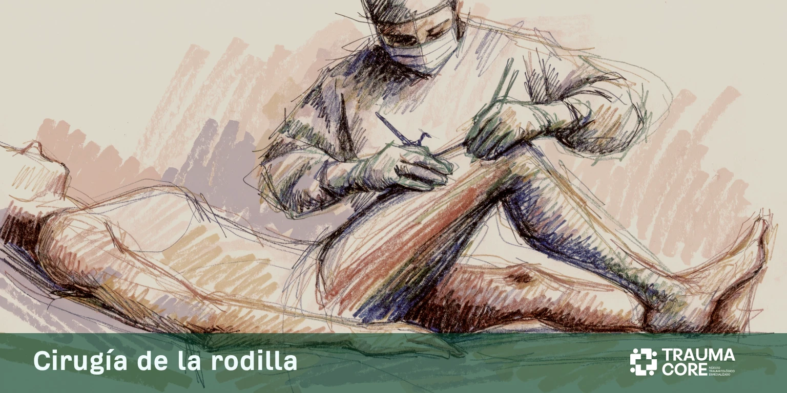 Cirugía de Rodilla
