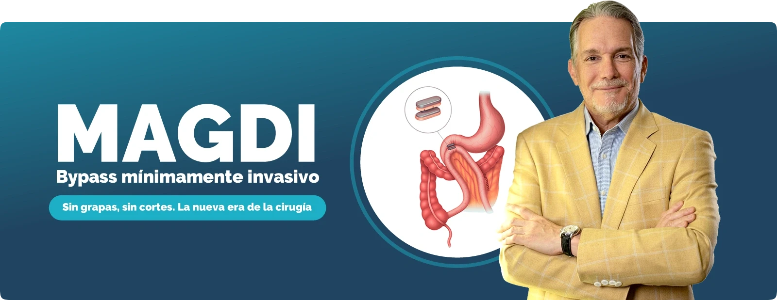 MagDI: Tecnología revolucionaria en cirugía bariátrica